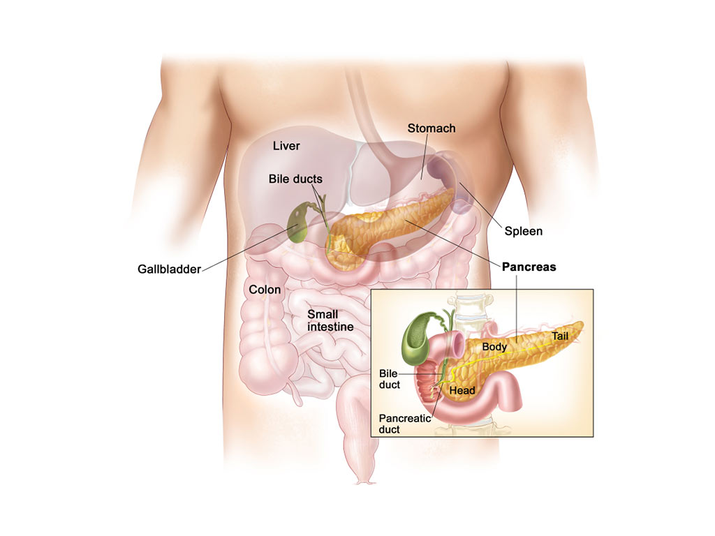 pancreas diabete di tipo 1